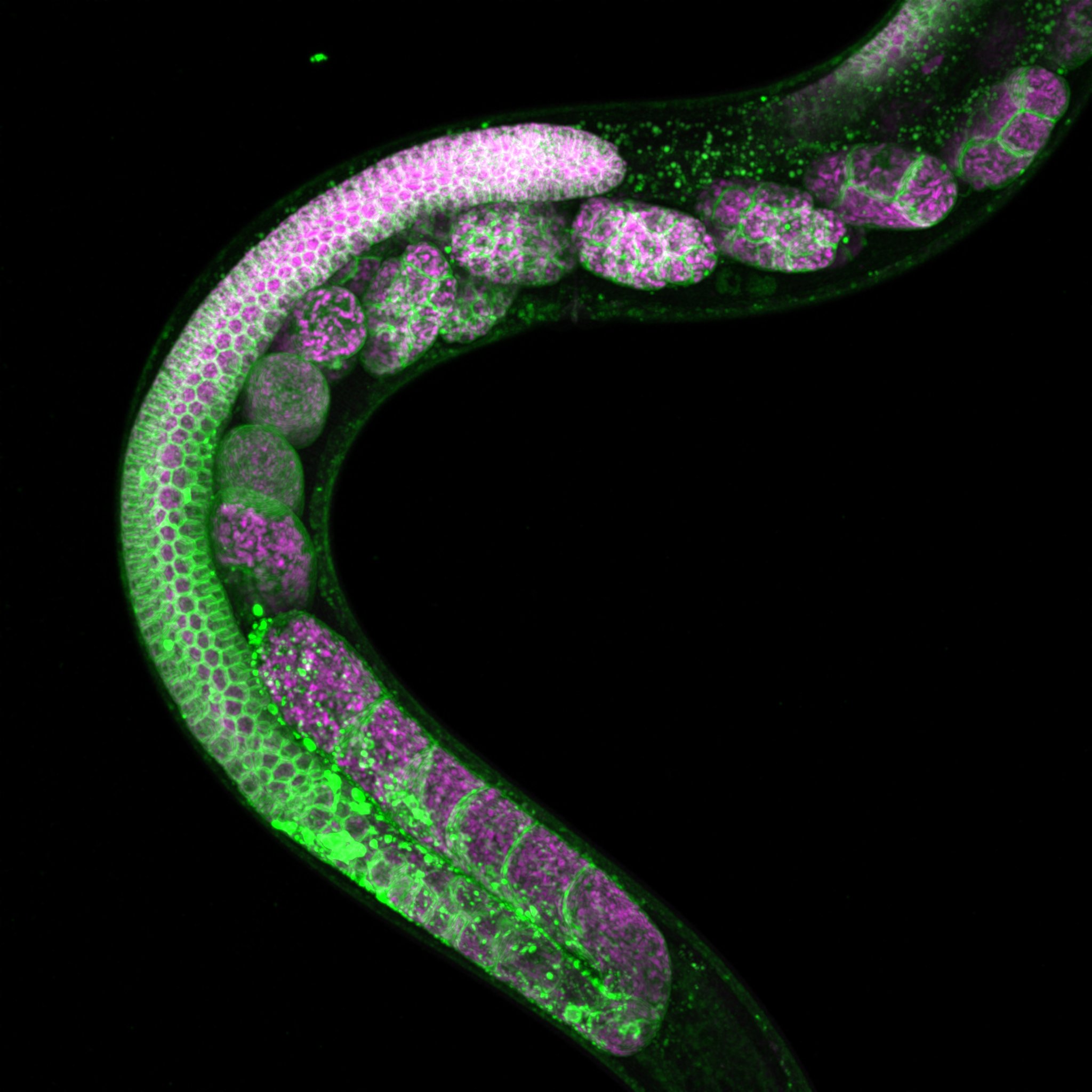 C elegans gonad with labeled mitochondria